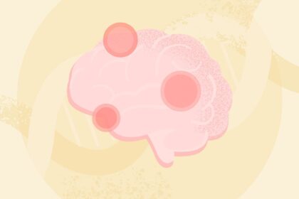 How Doctors Grade Glioblastoma Brain Tumors