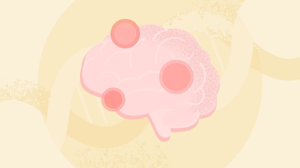 How Doctors Grade Glioblastoma Brain Tumors