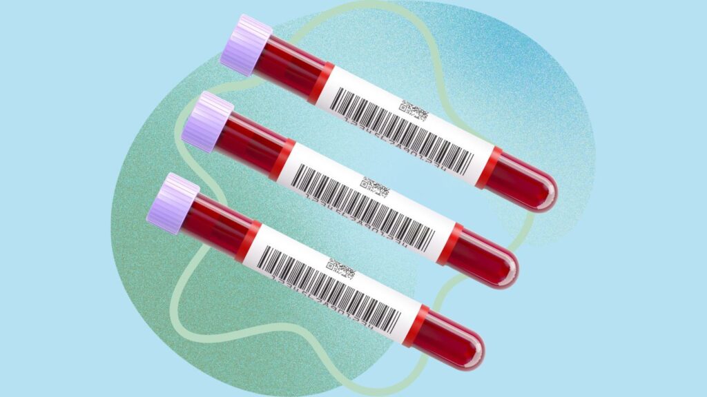 5 Lab Tests You Need