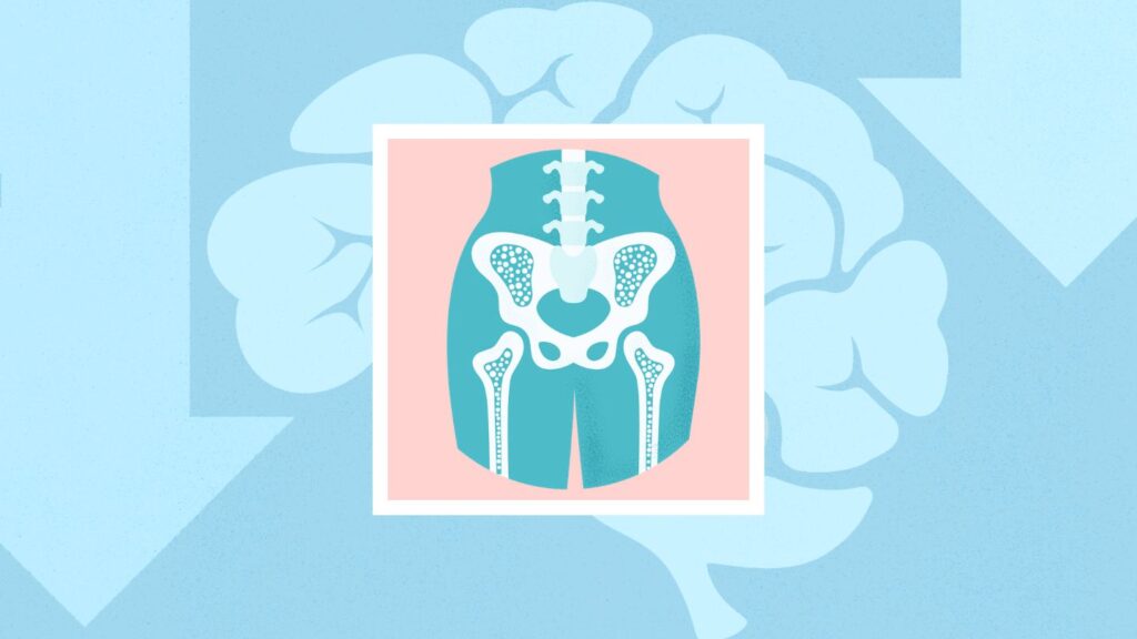 Is Bone Loss Linked to Dementia? New Study Offers Clues