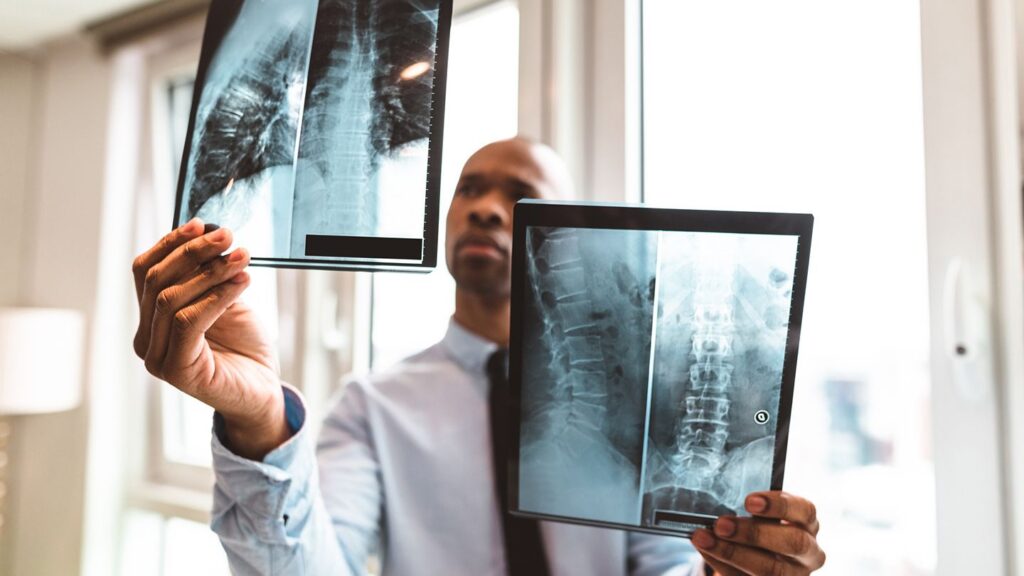 12 Common Medical Tests for Psoriatic Arthritis