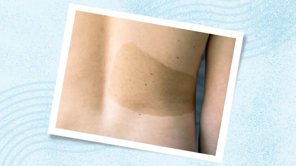Symptoms, Causes, Diagnosis, and Treatment